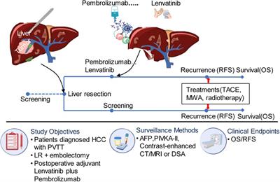 Postoperative adjuvant immunotherapy and molecular targeted therapy for patients of hepatocellular carcinoma with portal vein tumor thrombus after hepatectomy: a propensity score matching study